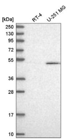 CUGBP1/CELF1 Antibody, Novus Biologicals 25 &mu;L; CUGBP1/CELF1 Antibody;